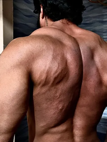 A close up on my back, showing the dense muscle and vascularity that comes from years of heavy training.