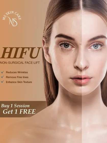HIFU, or High-Intensity Focused Ultrasound, is my go-to for a non-surgical facelift. It effectively reduces wrinkles, removes fine lines, and enhances skin texture by tightening the deeper layers of the skin, giving you a lifted and more sculpted look.