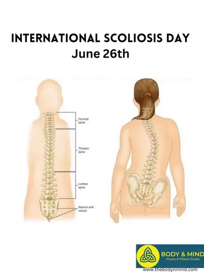 A duplicate of the Scoliosis Day infographic, reinforcing the message.