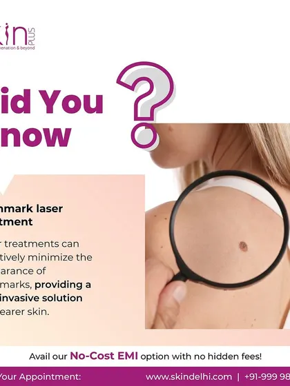 A "Did You Know" post highlighting that birthmark laser treatment can effectively minimize the appearance of birthmarks, offering a non-invasive solution for clearer skin.