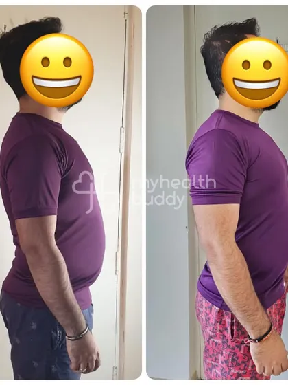 Another side view of Anshul's transformation.