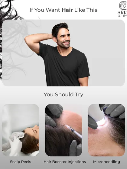 For those seeking significant improvement in hair density and health, I offer a combination of advanced treatments. This includes scalp peels to exfoliate and prepare the skin, hair booster injections for nourishment, and microneedling to stimulate growth.