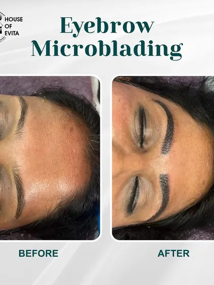 Here, I used Microblading to create a stronger, more defined brow shape that holds its form perfectly, day in and day out.