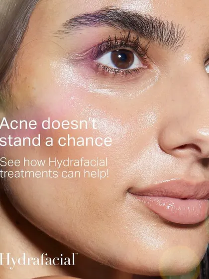 Acne doesn't stand a chance against a targeted HydraFacial treatment. It's a proven method to help clear breakouts and improve skin health.