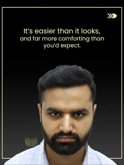 This is the result of a well-planned journey. It's not just about getting your hair back; it's about regaining the confidence to face the world. The process is more comfortable than you might think, and the results are predictable and natural.