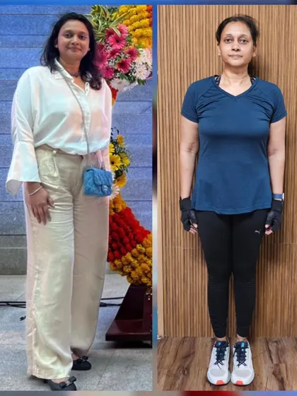 A duplicate of image 89, a powerful before-and-after.
