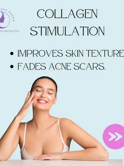 Benefit 5 of Peels for Acne: Collagen Stimulation. By promoting collagen, peels improve overall skin texture and help fade acne scars over time.