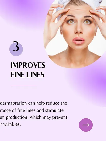 Reason 3 for Microdermabrasion: It improves fine lines and can help prevent deeper wrinkles by stimulating collagen.