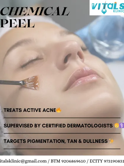 A chemical peel, when performed by a certified dermatologist, is a highly effective treatment for active acne. It exfoliates the skin, unclogs pores, and reduces pigmentation and dullness for a clearer complexion.