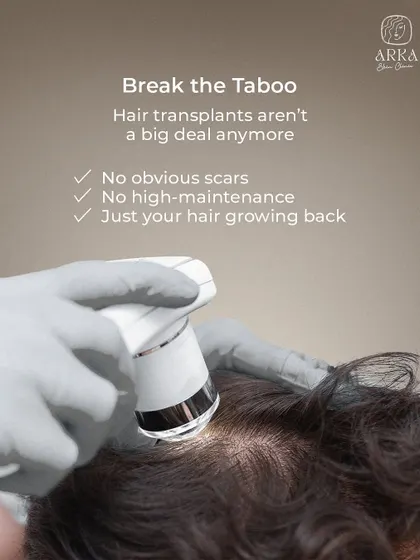Many people feel hesitant about hair transplants, but modern techniques have made it a straightforward procedure. I want to break this taboo. My methods ensure no obvious scars and no high maintenance, just your own hair growing back naturally.