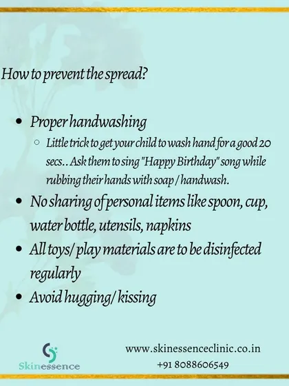 Preventing the spread of HFMD involves simple but crucial hygiene practices. This includes proper handwashing, disinfecting toys and surfaces, and not sharing personal items like utensils or water bottles.