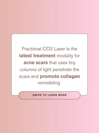 The Fractional CO2 laser is the latest treatment modality for acne scars. It uses tiny columns of light to penetrate scars and promote collagen remodeling for smoother skin.