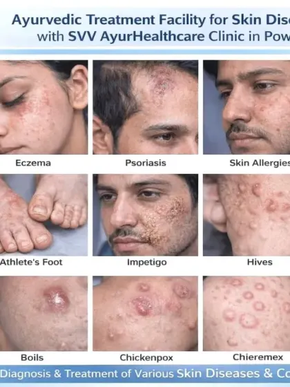 I treat a wide spectrum of skin diseases at my clinic. This collage shows some of the common conditions I can help you with, including acne, eczema, psoriasis, ringworm, and pigmentation issues like melasma. My goal is to provide an effective diagnosis and lasting treatment for your specific concern.