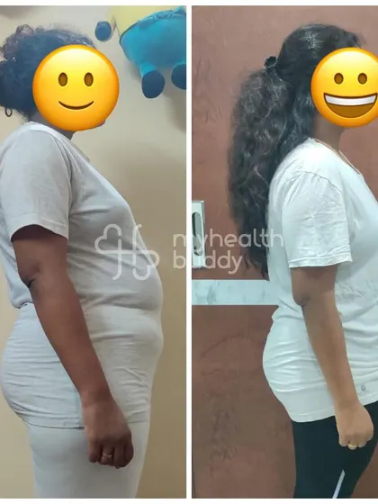This client lost 6 kgs in 3 months by making small, consistent changes. She learned to manage her food intake and appreciated the daily encouragement.