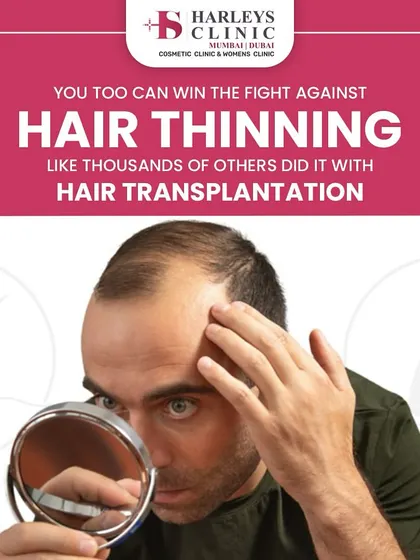 You can win the fight against hair thinning. Thousands of others have done it with hair transplantation, and I am here to guide you through the process.