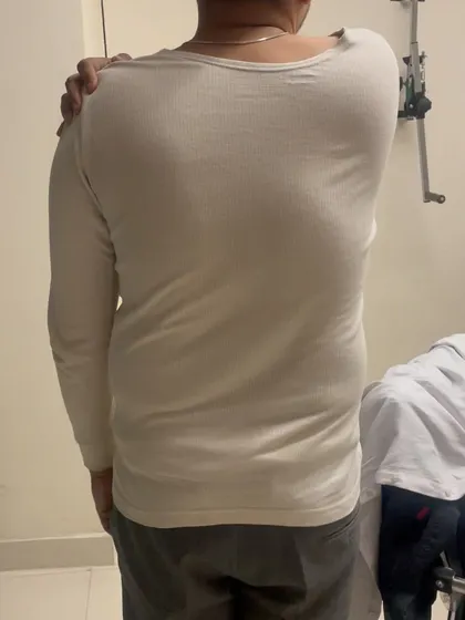 This was Mr. Deepak at the beginning of his treatment, unable to lift his arm to his shoulder due to pain and stiffness.