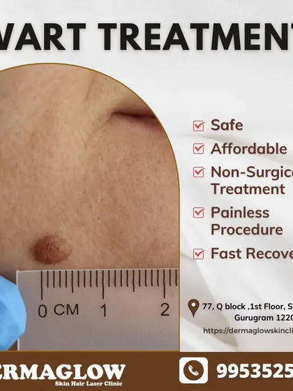Your safety and comfort are our priority. Our wart removal treatment is a non-surgical and virtually painless procedure that ensures a fast recovery, allowing you to return to your daily life with confidence.