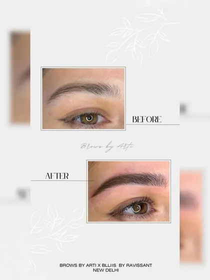 A powerful before and after comparison showcasing a complete brow transformation. The 'after' image reveals a fuller, perfectly arched brow with enhanced definition, achieved through our signature nanoblading technique by celebrity artist Arti Bagga.