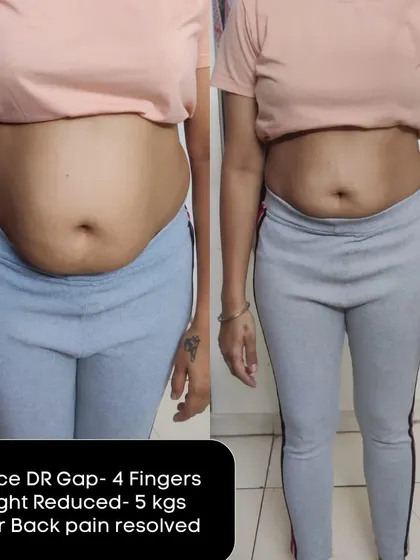 This mama resolved her lower back pain, lost 5 kgs, and reduced her DR gap by 4 fingers. This shows how core health is connected to overall well-being.