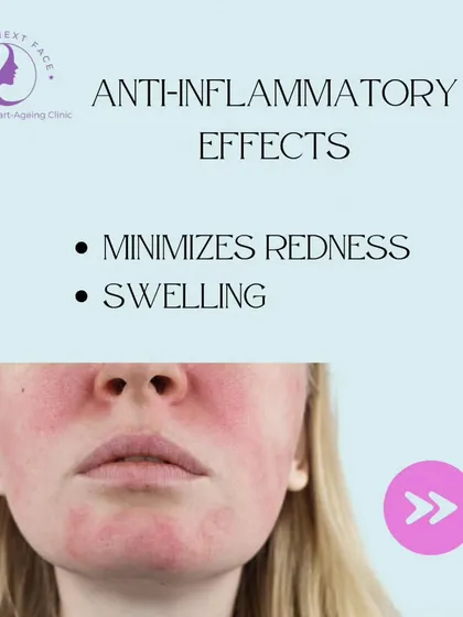 Benefit 4 of Peels for Acne: Anti-inflammatory Effects. Peels can minimize the redness and swelling associated with inflammatory acne.