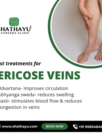 I offer a three part treatment for varicose veins that focuses on improving circulation and reducing swelling. The plan includes Udwarthana massage, Abhyanga Sweda (herbal oil massage with steam), and Basti to reduce congestion in the veins.