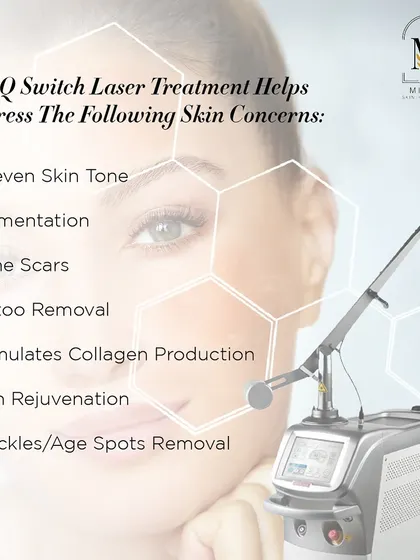 The Q-Switch laser is a multi-purpose tool I use to address uneven skin tone, pigmentation, acne scars, and even tattoo removal.