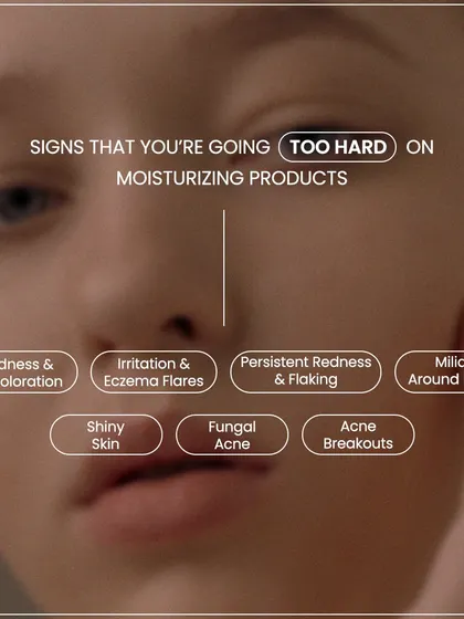 It is possible to go too hard on moisturizing. This graphic shows the signs of over-moisturizing, which can include clogged pores, milia, and even acne breakouts.