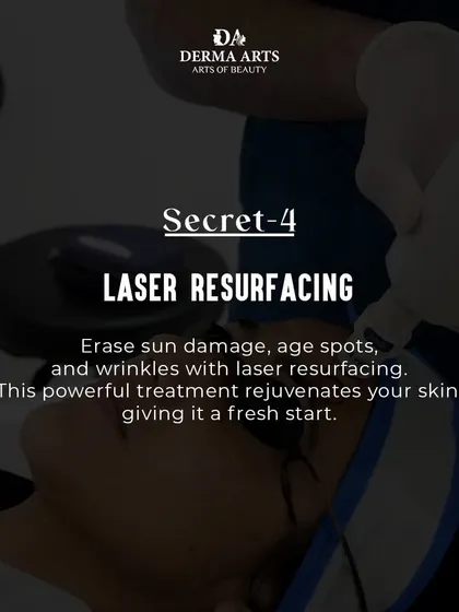 Laser resurfacing is a powerful anti-aging tool. It erases sun damage, age spots, and wrinkles, giving your skin a fresh start.