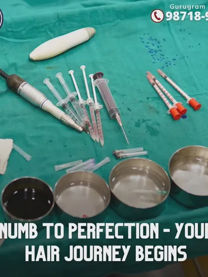 This is the setup for a hair transplant procedure. Every tool, from the FUE punch to the syringes for anesthesia, is sterile and laid out for a safe and efficient surgery. Your journey begins with this level of perfection.