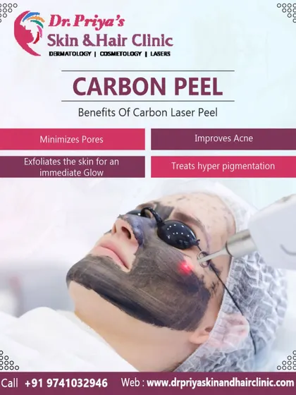 This infographic summarizes the key benefits of a carbon laser peel. It is an excellent multi-tasking treatment that minimizes pores, improves acne, provides an immediate glow through exfoliation, and treats hyperpigmentation.