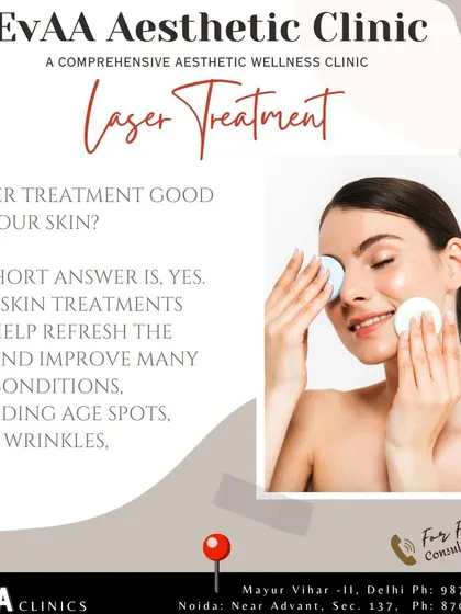 Is laser treatment good for your skin? Yes, our advanced laser skin treatments can refresh the skin and improve many conditions, including age spots, visible veins, and wrinkles.