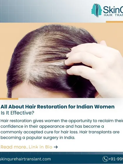 This article discusses hair restoration specifically for Indian women. Hair loss in women is common, and transplants are an effective and increasingly popular solution to reclaim their appearance and confidence.