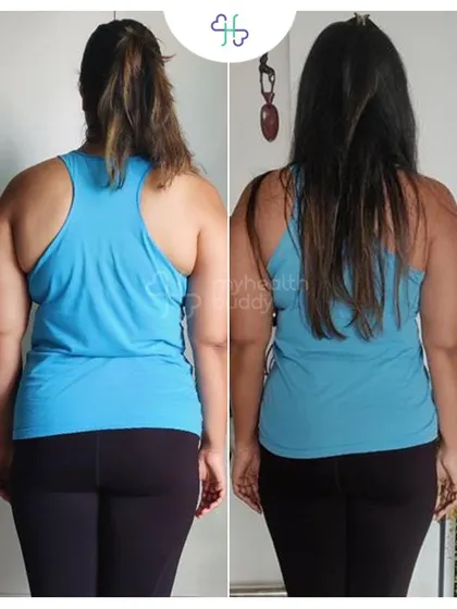 Ishani lost 7 kgs in 12 weeks. Her back transformation shows a significant reduction in fat, achieved by focusing on portion control and daily steps.