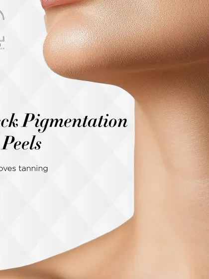 I use medicated peels to effectively treat neck pigmentation and tanning by promoting skin exfoliation and rejuvenation.