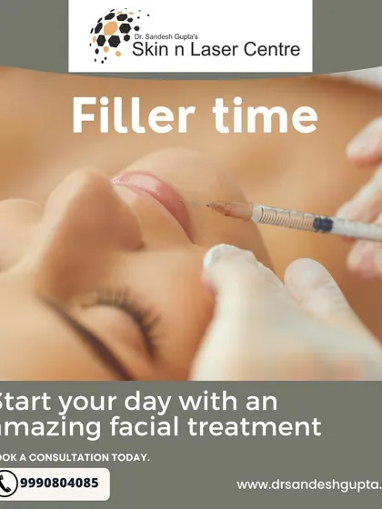 It's filler time. This image captures the moment of a facial filler treatment, an amazing way to start your day by investing in your skin's health and restoring its youthful volume.