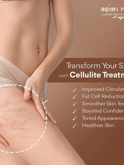 Cellulite is a common concern that I address with targeted treatments. My methods improve circulation and reduce fat cells, leading to smoother skin texture, a more toned appearance, and a significant boost in confidence.