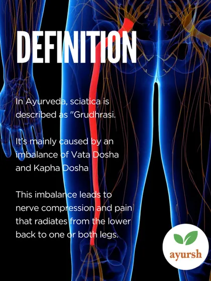 In Ayurveda, Sciatica is known as "Gridhrasi" and is caused by an imbalance of Vata and Kapha Dosha. This imbalance leads to nerve compression and the characteristic pain that radiates from the lower back to the legs.