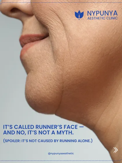 "Runner's face" is not a myth, and it's not caused by running alone. It refers to a fatigued, hollowed look that can develop in long-distance runners.