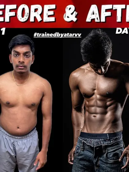 This client started with stretch marks and excess body fat. In 100 days, we completely transformed his physique, revealing a solid six-pack and muscular frame.