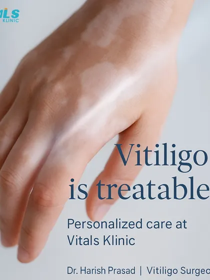 This image emphasizes that personalized care is the key to treating vitiligo. As a vitiligo surgeon, I tailor each treatment to the individual's needs, using advanced methods to achieve the best possible outcome.