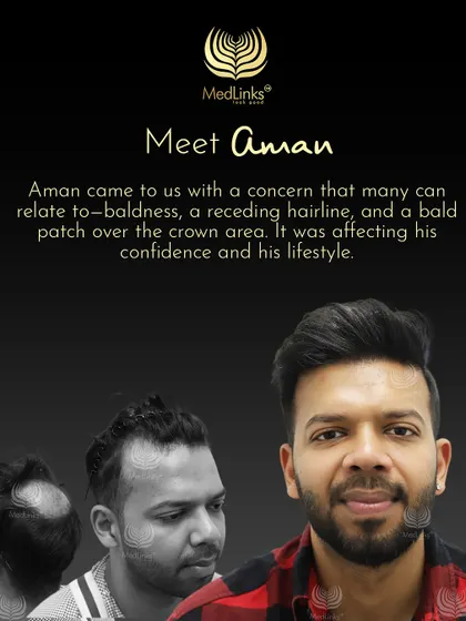 This collage tells the story of Aman, who came to us with a receding hairline and a bald patch on his crown.