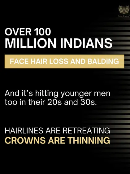Hair loss is a widespread issue, affecting over 100 million Indians, including men in their 20s and 30s. Understanding its prevalence is the first step toward seeking a solution.