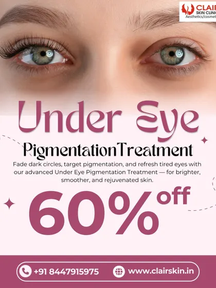 Fade dark circles and refresh tired eyes with our advanced Under Eye Pigmentation Treatment. This service is designed to give you brighter, smoother, and rejuvenated skin.