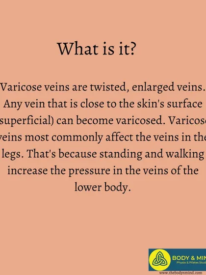 This infographic defines varicose veins, which are caused by increased pressure in the lower body from standing and walking.