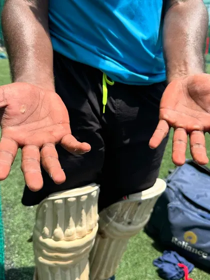 A duplicate of the powerful image of a batsman's hands, emphasizing the hard work required.