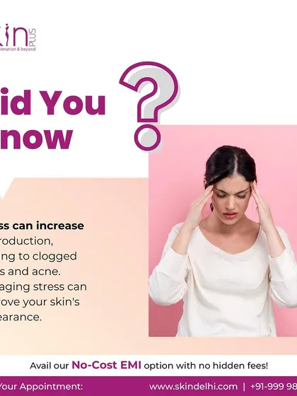 A "Did You Know" post explaining the link between stress and skin health. It notes that stress can increase oil production, leading to clogged pores and acne.