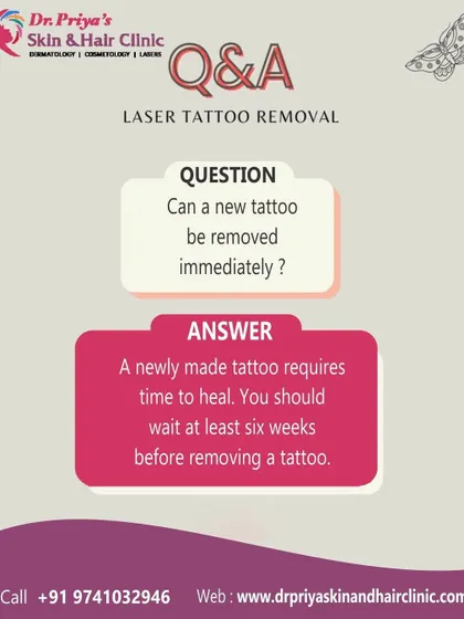 It is a common question whether a new tattoo can be removed immediately. For patient safety and optimal results, it is necessary to wait at least six weeks for the skin to fully heal before beginning any laser removal treatment.