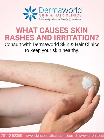 If you are experiencing intense itching and skin rashes, it could be an allergic reaction or a chronic condition. Instead of guessing the cause, a professional consultation can provide a clear diagnosis and an effective treatment plan.
