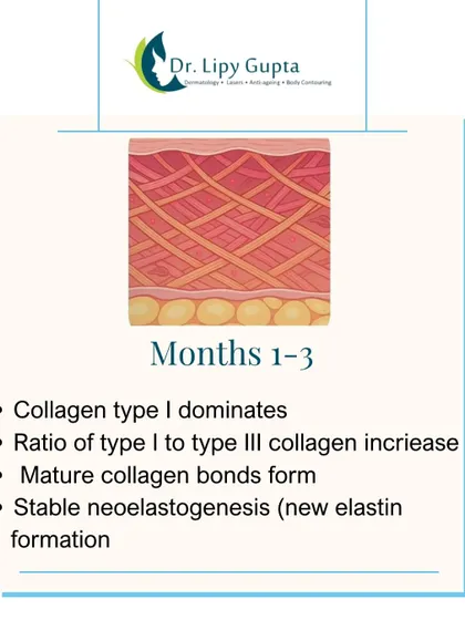 In months 1 to 3, mature collagen dominates and stable new elastin forms. This is when you see the most significant improvements in skin firmness and texture.