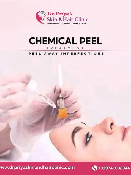 Chemical peel treatments are designed to peel away imperfections. By removing the outermost layer of the skin, they reveal a smoother, more radiant complexion underneath.
